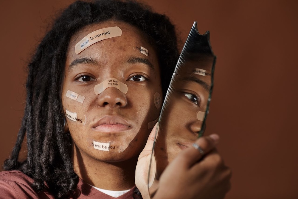 Image of a woman with plasters on her face with notes about self worth written on them, what causes low self esteem blog by Rowenna Clifford Hypnotherapy